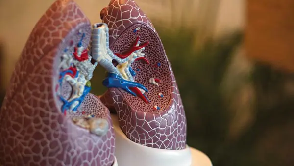 Medical Myths: All about lung cancer